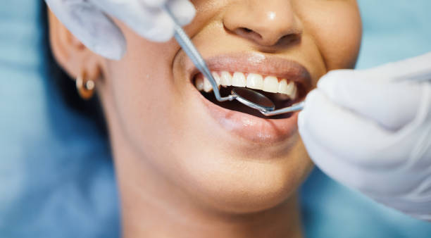 Best Emergency Tooth Extraction in Rural Hill, TN